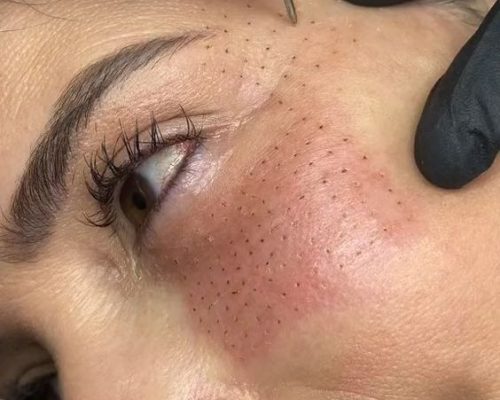 f6418329e1a98a817921fbea54a2e72f